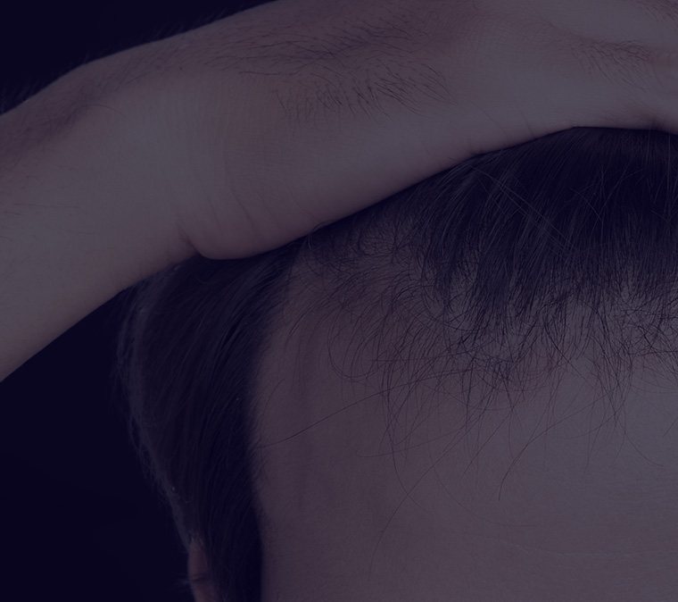 M자로 올라간 남성의 헤어라인